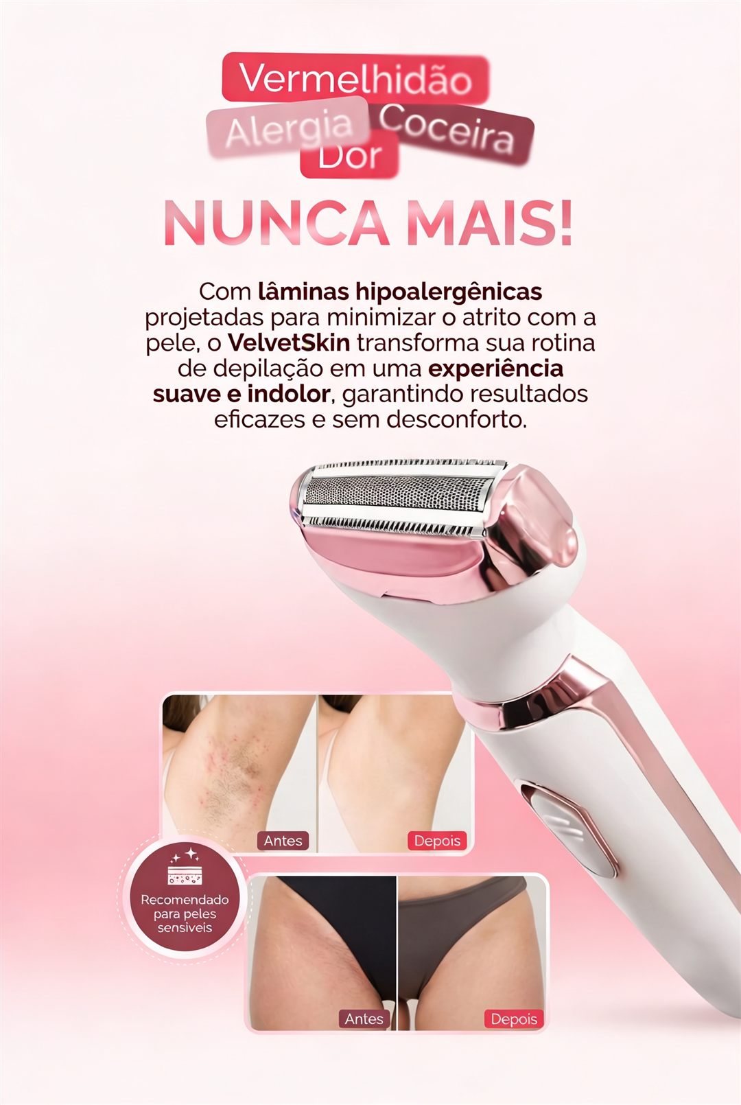 VelvetSkin: vermelhidão, alergia, coceira e dor nunca mais