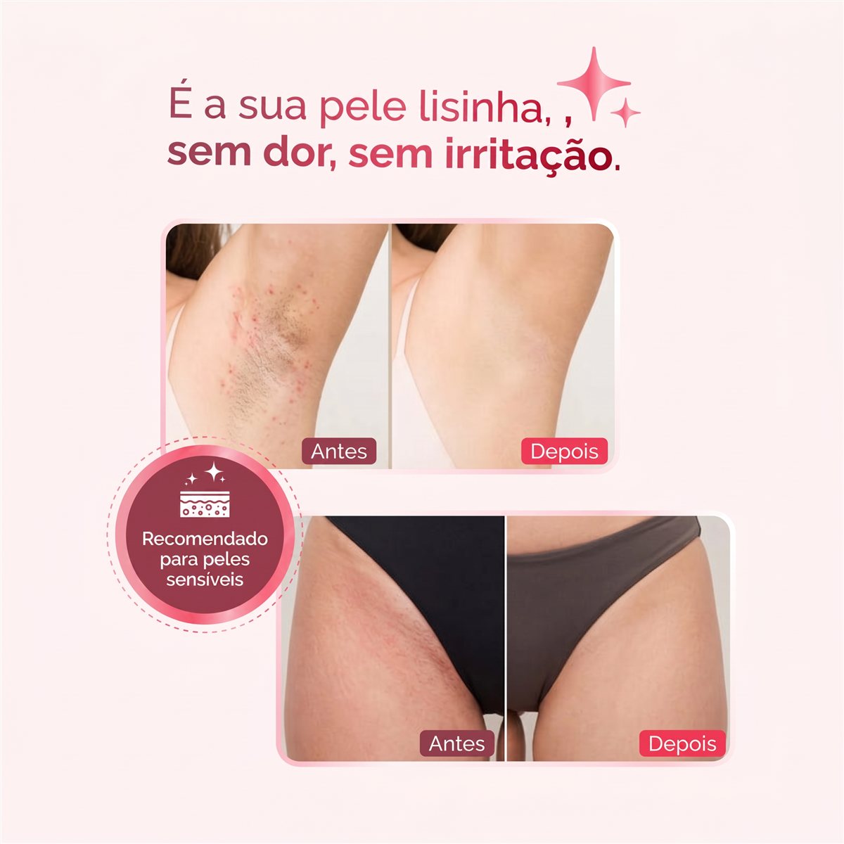 Depilador Elétrico VelvetSkin 4 em 1