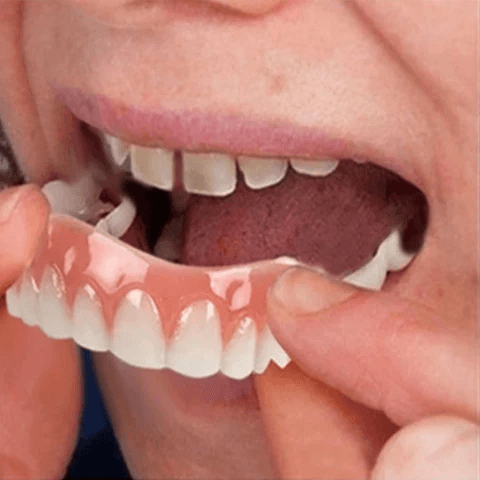 Dentadura Universal NewSmile Ajustável, Discreta e Confortável - Kit Prótese Dental Completa - Compre 1 e Leve 2