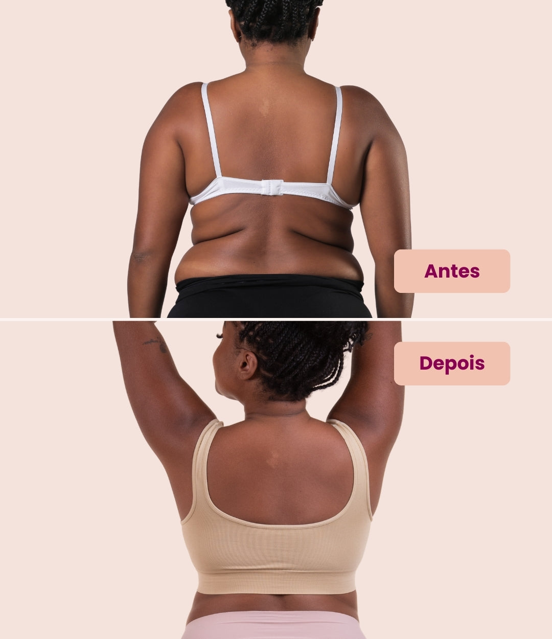 Antes e depois das costas